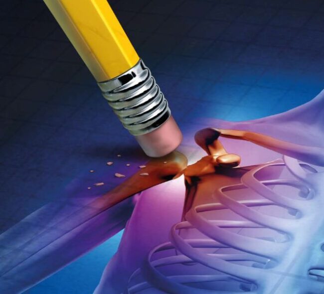 4373-osteoporoza_po_lekach